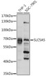 Western blot analysis of various lysates using SLC5A5 pAb (STJ113663) at 1:1000 dilution. <br/>Secondary antibody: HRP-conjugated Goat anti-Rabbit IgG (H+L) (STJS000856) at 1:10000 dilution. <br/>Lysates/proteins: 25 Mu g per lane. <br/>Blocking buffer: 3% nonfat dry milk in TBST. <br/>Detection: ECL Basic Kit <br/>Exposure time: 1s.