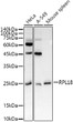 Western blot analysis of extracts of various cell lines, using RPL18 antibody (STJ113682) at 1:1000 dilution. Secondary antibody: HRP Goat Anti-Rabbit IgG (H+L) (STJS000856) at 1:10000 dilution. Lysates/proteins: 25 Mu g per lane. Blocking buffer: 3% nonfat dry milk in TBST. Detection: ECL Basic Kit. Exposure time: 90s.
