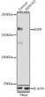 Western blot analysis of extracts from normal (control) and EGFR knockout (KO) HeLa cells, using EGFR antibody (STJ113701) at 1:1000 dilution. Secondary antibody: HRP Goat Anti-rabbit IgG (H+L) (STJS000856) at 1:10000 dilution. Lysates/proteins: 25 Mu g per lane. Blocking buffer: 3% non-fat dry milk in TBST. Detection: ECL Basic Kit. Exposure time: 90s.