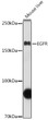 Western blot analysis of extracts of mouse liver, using EGFR antibody (STJ113701) at 1:1000 dilution. Secondary antibody: HRP Goat Anti-rabbit IgG (H+L) (STJS000856) at 1:10000 dilution. Lysates/proteins: 25 Mu g per lane. Blocking buffer: 3% non-fat dry milk in TBST. Detection: ECL Basic Kit. Exposure time: 90s.