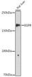 Western blot analysis of extracts of Rat liver, using EGFR antibody (STJ113701) at 1:1000 dilution. Secondary antibody: HRP Goat Anti-rabbit IgG (H+L) (STJS000856) at 1:10000 dilution. Lysates/proteins: 25 Mu g per lane. Blocking buffer: 3% non-fat dry milk in TBST. Detection: ECL Enhanced Kit. Exposure time: 180s.