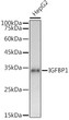 Western blot analysis of extracts of HepG2 cells, using IGFBP1 antibody (STJ113709) at 1:1000 dilution. Secondary antibody: HRP Goat Anti-Rabbit IgG (H+L) (STJS000856) at 1:10000 dilution. Lysates/proteins: 25 Mu g per lane. Blocking buffer: 3% nonfat dry milk in TBST. Detection: ECL Basic Kit. Exposure time: 3s.