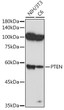 Western blot analysis of extracts of various cell lines, using PTEN antibody (STJ113730) at 1:1000 dilution. Secondary antibody: HRP Goat Anti-rabbit IgG (H+L) (STJS000856) at 1:10000 dilution. Lysates/proteins: 25 Mu g per lane. Blocking buffer: 3% non-fat dry milk in TBST. Detection: ECL Basic Kit. Exposure time: 90s.