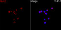 Immunofluorescence analysis of THP-1 cells using Bcl-2 Rabbit polyclonal antibody (STJ113759) at a dilution of 1:150 (40x lens). Secondary antibody: Cy3 Goat Anti-Rabbit IgG (H+L) at 1:500 dilution. Blue: DAPI for nuclear staining.