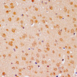 Immunohistochemistry analysis of Bcl-2 in paraffin-embedded mouse brain tissue using Bcl-2 Rabbit polyclonal antibody (STJ113759) at a dilution of 1:200 (40x lens). Microwave antigen retrieval was performed with 0. 01 M PBS buffer (pH 7. 2±0. 2) prior to immunohistochemistry staining.