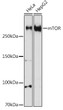Western blot analysis of extracts of various cell lines, using mTOR antibody (STJ113771) at 1:500 dilution. Secondary antibody: HRP Goat Anti-rabbit IgG (H+L) (STJS000856) at 1:10000 dilution. Lysates/proteins: 25 Mu g per lane. Blocking buffer: 3% non-fat dry milk in TBST. Detection: ECL Basic Kit. Exposure time: 60s.