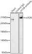 Immunoprecipitation analysis of 300ug extracts of K-562 cells using 3ug mTOR rabbit polyclonal antibody (STJ113771 1:50). Western blot was performed from the immunoprecipitate using mTOR rabbit polyclonal antibody (A2445) at a dilition of 1:500.