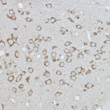 Immunohistochemistry analysis of paraffin-embedded rat brain using BiP/GRP78 Rabbit polyclonal antibody (STJ113776) at dilution of 1:100 (40x lens). Perform high pressure antigen retrieval with 10 mM citrate buffer pH 6. 0 before commencing with immunohistochemistry staining protocol.