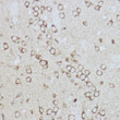 Immunohistochemistry analysis of paraffin-embedded mouse brain using BiP/GRP78 Rabbit polyclonal antibody (STJ113776) at dilution of 1:100 (40x lens). Perform high pressure antigen retrieval with 10 mM citrate buffer pH 6. 0 before commencing with immunohistochemistry staining protocol.