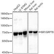 Western blot analysis of extracts of various cell lines, using BiP/GRP78 antibody (STJ113776) at 1:1000 dilution. Secondary antibody: HRP Goat Anti-Rabbit IgG (H+L) (STJS000856) at 1:10000 dilution. Lysates/proteins: 25 Mu g per lane. Blocking buffer: 3% nonfat dry milk in TBST. Detection: ECL Basic Kit. Exposure time: 10s.