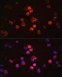 Immunofluorescence analysis of THP-1 cells using IL1 Beta Rabbit polyclonal antibody (STJ113778) at dilution of 1:100. Secondary antibody: Cy3 Goat Anti-Rabbit IgG (H+L) at 1:500 dilution. Blue: DAPI for nuclear staining.