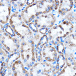 Immunohistochemistry analysis of paraffin-embedded Rat kidney using CTGF rabbit polyclonal antibody (STJ113799) at dilution of 1:100 (40x lens). Perform microwave antigen retrieval with 10 mM PBS buffer pH 7. 2 before commencing with immunohistochemistry staining protocol.