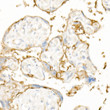 Immunohistochemistry analysis of EGFR in paraffin-embedded human placenta using [KD Validated] EGFR Rabbit polyclonal antibody (STJ113840) at dilution of 1:20 (40x lens). Perform high pressure antigen retrieval with 10 mM citrate buffer pH 6. 0 before commencing with immunohistochemistry staining protocol.