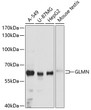 Western blot analysis of various lysates using GLMN Rabbit polyclonal antibody (STJ113926) at 1:3000 dilution. Secondary antibody: HRP Goat Anti-Rabbit IgG (H+L) (STJS000856) at 1:10000 dilution. Lysates/proteins: 25 Mu g per lane. Blocking buffer: 3% nonfat dry milk in TBST. Detection: ECL Basic Kit. Exposure time: 10s.