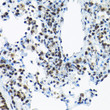 Immunohistochemistry analysis of SNRPA1 in paraffin-embedded rat lung using SNRPA1 Rabbit polyclonal antibody (STJ114054) at dilution of 1:200 (40x lens). Perform high pressure antigen retrieval with 10 mM citrate buffer pH 6. 0 before commencing with immunohistochemistry staining protocol.