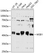 Western blot analysis of various lysates using WSB1 Rabbit polyclonal antibody (STJ114087) at 1:1000 dilution. _Secondary antibody: HRP Goat Anti-Rabbit IgG (H+L) (STJS000856) at 1:10000 dilution. _Lysates/proteins: 25 Mu g per lane. _Blocking buffer: 3% nonfat dry milk in TBST. _Detection: ECL Enhanced Kit. _Exposure time: 10s.