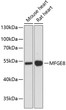 Western blot analysis of various lysates using MFGE8 Rabbit polyclonal antibody (STJ114205) at 1:3000 dilution. Secondary antibody: HRP Goat Anti-Rabbit IgG (H+L) (STJS000856) at 1:10000 dilution. Lysates/proteins: 25 Mu g per lane. Blocking buffer: 3% nonfat dry milk in TBST. Detection: ECL Enhanced Kit. Exposure time: 90s.