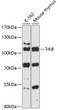 Western blot analysis of various lysates using TrkB Rabbit polyclonal antibody (STJ114207) at 1:3000 dilution. Secondary antibody: HRP Goat Anti-Rabbit IgG (H+L) (STJS000856) at 1:10000 dilution. Lysates/proteins: 25 Mu g per lane. Blocking buffer: 3% nonfat dry milk in TBST. Detection: ECL Basic Kit. Exposure time: 30s.
