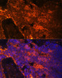 Immunofluorescence analysis of paraffin-embedded rat bone marrow using alpha 1 Spectrin Rabbit polyclonal antibody (STJ114233) at dilution of 1:100. Secondary antibody: Cy3 Goat Anti-Rabbit IgG (H+L) at 1:500 dilution. Blue: DAPI for nuclear staining.