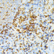 Immunohistochemistry analysis of alpha 1 Spectrin in paraffin-embedded rat spleen using alpha 1 Spectrin Rabbit polyclonal antibody (STJ114233) at dilution of 1:100 (40x lens). Perform microwave antigen retrieval with 10 mM PBS buffer pH 7. 2 before commencing with immunohistochemistry staining protocol.