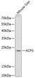 Western blot analysis of extracts of mouse liver, using ACP1 Antibody (STJ114268) at 1:1000 dilution. Secondary antibody: HRP Goat Anti-Rabbit IgG (H+L) (STJS000856) at 1:10000 dilution. Lysates/proteins: 25 Mu g per lane. Blocking buffer: 3% nonfat dry milk in TBST.