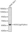 Western blot analysis of RAW 264. 7, using NOX2/gp91phox Rabbit polyclonal antibody (STJ114304) at 1:900 dilution. Secondary antibody: HRP Goat Anti-Rabbit IgG (H+L) (STJS000856) at 1:10000 dilution. Lysates/proteins: 25ug per lane. Blocking buffer: 3% nonfat dry milk in TBST. Detection: ECL Basic Kit. Exposure time: 90s.