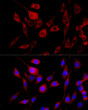 Immunofluorescence analysis of PC-12 cells using FGFR2 antibody (STJ114310) at dilution of 1:100 (40x lens). Blue: DAPI for nuclear staining.