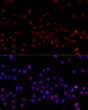 Immunofluorescence analysis of 293T cells using HNRNPL antibody (STJ114321) at dilution of 1:100 (40x lens). Blue: DAPI for nuclear staining.