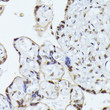 Immunohistochemistry analysis of paraffin-embedded human placenta using HNRNPL antibody (STJ114321) at dilution of 1:100 (40x lens). Perform microwave antigen retrieval with 10 mM PBS buffer pH 7. 2 before commencing with immunohistochemistry staining protocol.