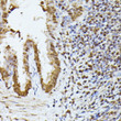 Immunohistochemistry analysis of paraffin-embedded rat lung using HNRNPL antibody (STJ114321) at dilution of 1:100 (40x lens). Perform microwave antigen retrieval with 10 mM PBS buffer pH 7. 2 before commencing with immunohistochemistry staining protocol.