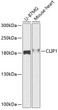 Western blot analysis of extracts of various cell lines, using CLIP1 antibody (STJ114372) at 1:1000 dilution. Secondary antibody: HRP Goat Anti-Rabbit IgG (H+L) (STJS000856) at 1:10000 dilution. Lysates/proteins: 25 Mu g per lane. Blocking buffer: 3% nonfat dry milk in TBST. Detection: ECL Basic Kit. Exposure time: 60s.