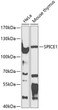 Western blot analysis of various lysates using CCDC52 Rabbit pAb (STJ114485) at 1:1000 dilution. <br/>Secondary antibody: HRP-conjugated Goat anti-Rabbit IgG (H+L) (STJS000856) at 1:10000 dilution. <br/>Lysates/proteins: 25 Mu g per lane. <br/>Blocking buffer: 3% nonfat dry milk in TBST. <br/>Detection: ECL Basic Kit <br/>Exposure time: 90s.