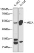 Western blot analysis of extracts of various cell lines, using MICA Antibody (STJ114496) at 1:1000 dilution. Secondary antibody: HRP Goat Anti-Rabbit IgG (H+L) (STJS000856) at 1:10000 dilution. Lysates/proteins: 25 Mu g per lane. Blocking buffer: 3% nonfat dry milk in TBST.