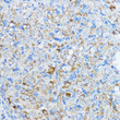 Immunohistochemistry analysis of paraffin-embedded rat ovary using Aromatase (CYP19A1) antibody (STJ114557) at dilution of 1:100 (40x lens). Perform microwave antigen retrieval with 10 mM PBS buffer pH 7. 2 before commencing with immunohistochemistry staining protocol.