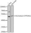 Western blot analysis of extracts of various cell lines, using Aromatase (CYP19A1) antibody (STJ114557) at 1:3000 dilution. Secondary antibody: HRP Goat Anti-Rabbit IgG (H+L) (STJS000856) at 1:10000 dilution. Lysates/proteins: 25 Mu g per lane. Blocking buffer: 3% nonfat dry milk in TBST. Detection: ECL Basic Kit. Exposure time: 20s.