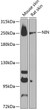 Western blot analysis of various lysates using NIN Rabbit pAb (STJ114607) at 1:1000 dilution. <br/>Secondary antibody: HRP-conjugated Goat anti-Rabbit IgG (H+L) (STJS000856) at 1:10000 dilution. <br/>Lysates/proteins: 25 Mu g per lane. <br/>Blocking buffer: 3% nonfat dry milk in TBST. <br/>Detection: ECL Basic Kit <br/>Exposure time: 90s.