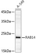 Western blot analysis of extracts of A-549 cells, using RAB14 antibody (STJ114625) at 1:1000 dilution. Secondary antibody: HRP Goat Anti-Rabbit IgG (H+L) (STJS000856) at 1:10000 dilution. Lysates/proteins: 25 Mu g per lane. Blocking buffer: 3% nonfat dry milk in TBST. Detection: ECL Basic Kit. Exposure time: 180s.