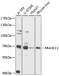 Western blot analysis of various lysates using MAN1C1 Rabbit polyclonal antibody (STJ114703) at 1:3000 dilution. Secondary antibody: HRP Goat Anti-Rabbit IgG (H+L) (STJS000856) at 1:10000 dilution. Lysates/proteins: 25 Mu g per lane. Blocking buffer: 3% nonfat dry milk in TBST. Detection: ECL Basic Kit. Exposure time: 90s.