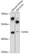 Western blot analysis of various lysates using GNAL Rabbit pAb (STJ114734) at 1:3000 dilution. <br/>Secondary antibody: HRP-conjugated Goat anti-Rabbit IgG (H+L) (STJS000856) at 1:10000 dilution. <br/>Lysates/proteins: 25 Mu g per lane. <br/>Blocking buffer: 3% nonfat dry milk in TBST. <br/>Detection: ECL Basic Kit <br/>Exposure time: 10s.