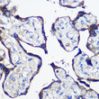 Immunohistochemistry analysis of PARP8 in paraffin-embedded Human placenta using PARP8 Rabbit polyclonal antibody (STJ114760) at dilution of 1:100 (40x lens). Perform microwave antigen retrieval with 10 mM PBS buffer pH 7. 2 before commencing with immunohistochemistry staining protocol. Immunohistochemistry analysis of PARP8 in paraffin-embedded Human placenta using PARP8 Rabbit polyclonal antibody (STJ114760) at dilution of 1:100 (40x lens). Perform microwave antigen retrieval with 10 mM PBS buffer pH 7. 2 before commencing with immunohistochemistry staining protocol.