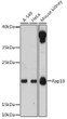 Western blot analysis of various lysates using Rap1B Rabbit polyclonal antibody (STJ114791) at 1:3000 dilution. Secondary antibody: HRP Goat Anti-Rabbit IgG (H+L) (STJS000856) at 1:10000 dilution. Lysates/proteins: 25 Mu g per lane. Blocking buffer: 3% nonfat dry milk in TBST. Detection: ECL Enhanced Kit. Exposure time: 30s. Western blot analysis of various lysates using Rap1B Rabbit polyclonal antibody (STJ114791) at 1:3000 dilution. Secondary antibody: HRP Goat Anti-Rabbit IgG (H+L) (STJS000856) at 1:10000 dilution. Lysates/proteins: 25 Mu g per lane. Blocking buffer: 3% nonfat dry milk in TBST. Detection: ECL Enhanced Kit. Exposure time: 30s.