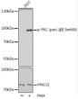 Western blot analysis of lysates from 293T cells, using Phospho-PKC (pan) ( Beta II Ser660) pAb (STJ114838) at 1:1000 dilution or PRKCQ antibody (STJ28397). 293T cells were treated by PMA/TPA (200nM) for 30 minutes after serum-starvation overnight. <br/>Secondary antibody: HRP-conjugated Goat anti-Rabbit IgG (H+L) (STJS000856) at 1:10000 dilution. <br/>Lysates/proteins: 25 Mu g per lane. <br/>Blocking buffer: 3% BSA. <br/>Detection: ECL Basic Kit <br/>Exposure time: 90s.