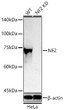 Western blot analysis of lysates from wild type (WT) and NF2 knockdown (KD) HeLa cells using [KD Validated] NF2 Rabbit polyclonal antibody (STJ114897) at 1:1000 dilution incubated overnight at 4 °C. Secondary antibody: HRP-conjugated Goat anti-Rabbit IgG (H+L) (STJS000856) at 1:10000 dilution. Lysates/proteins: 25 Mu g per lane. Blocking buffer: 3% nonfat dry milk in TBST. Detection: ECL Basic KitExposure time: 180 s.