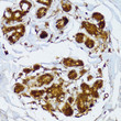 Immunohistochemistry of paraffin-embedded human breast using IRF3 antibody (STJ114901) at dilution of 1:100 (40x lens). Perform microwave antigen retrieval with 10 mM PBS buffer pH 7. 2 before commencing with immunohistochemistry staining protocol.