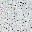 Immunohistochemistry analysis of paraffin-embedded rat liver using CDK9 Rabbit polyclonal antibody (STJ114907) at dilution of 1:200 (40x lens). Perform high pressure antigen retrieval with 10 mM citrate buffer pH 6. 0 before commencing with immunohistochemistry staining protocol.