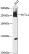 Western blot analysis of lysates from 293T cells, using KNTC1 Rabbit polyclonal antibody (STJ115031) at 1:3000 dilution. Secondary antibody: HRP Goat Anti-Rabbit IgG (H+L) (STJS000856) at 1:10000 dilution. Lysates/proteins: 25 Mu g per lane. Blocking buffer: 3% nonfat dry milk in TBST. Detection: ECL Basic Kit. Exposure time: 30s.