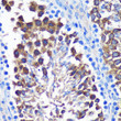 Immunohistochemistry analysis of SENP1 in paraffin-embedded Mouse testis using SENP1 Rabbit polyclonal antibody (STJ115053) at dilution of 1:100 (40x lens). Perform microwave antigen retrieval with 10 mM PBS buffer pH 7. 2 before commencing with immunohistochemistry staining protocol.