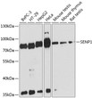 Western blot analysis of various lysates using SENP1 Rabbit polyclonal antibody (STJ115053) at 1:3000 dilution. Secondary antibody: HRP Goat Anti-Rabbit IgG (H+L) (STJS000856) at 1:10000 dilution. Lysates/proteins: 25 Mu g per lane. Blocking buffer: 3% nonfat dry milk in TBST. Detection: ECL Basic Kit. Exposure time: 90s.