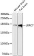 Western blot analysis of various lysates using LRRC7 Rabbit polyclonal antibody (STJ115080) at 1:3000 dilution. Secondary antibody: HRP Goat Anti-Rabbit IgG (H+L) (STJS000856) at 1:10000 dilution. Lysates/proteins: 25 Mu g per lane. Blocking buffer: 3% nonfat dry milk in TBST. Detection: ECL Basic Kit. Exposure time: 90s.