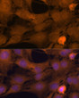 Immunofluorescence analysis of C6 cells using ZC3H7A Rabbit polyclonal antibody (STJ115156) at dilution of 1:100. Secondary antibody: Cy3 Goat Anti-Rabbit IgG (H+L) at 1:500 dilution. Blue: DAPI for nuclear staining.